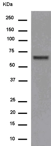 Western blot - Anti-EDEM2 antibody [EPR14043-24] (AB180522)