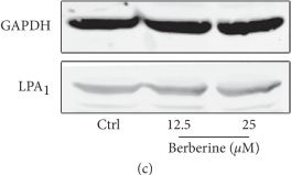 Western blot - Anti-EDG2 /LPA-1 antibody (AB23698)