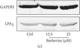 Western blot - Anti-EDG2 /LPA-1 antibody (AB23698)
