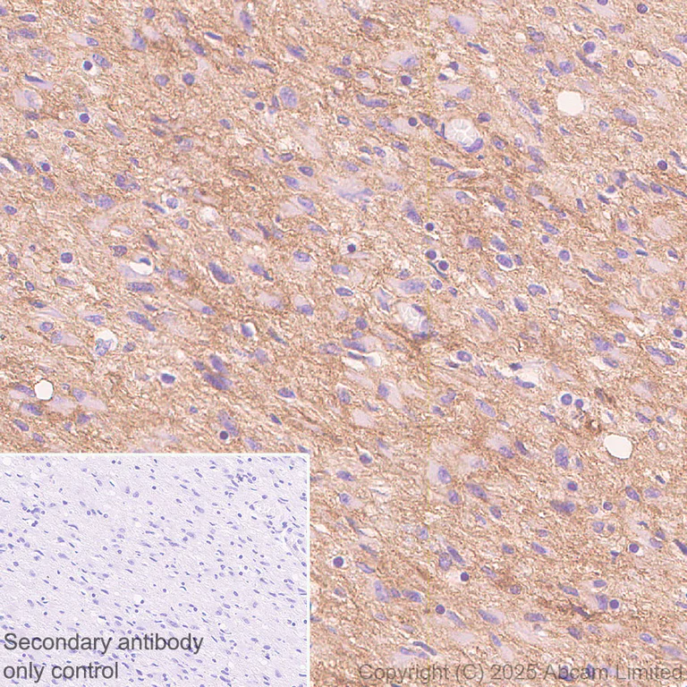 Immunohistochemistry (Formalin/PFA-fixed paraffin-embedded sections) - Anti-EDG2/LPA-1 antibody [EPR30753-555] (AB325552)