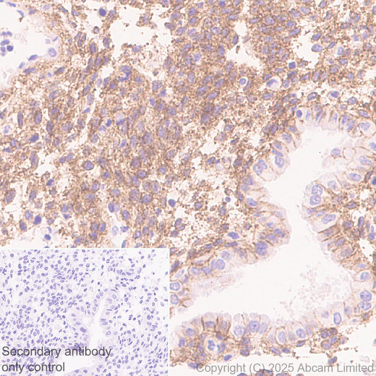 Immunohistochemistry (Formalin/PFA-fixed paraffin-embedded sections) - Anti-EDG2/LPA-1 antibody [EPR30753-555] (AB325552)