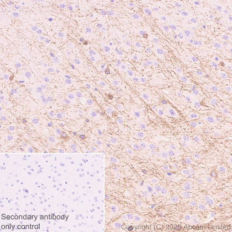 Immunohistochemistry (Formalin/PFA-fixed paraffin-embedded sections) - Anti-EDG2/LPA-1 antibody [EPR30753-555] (AB325552)
