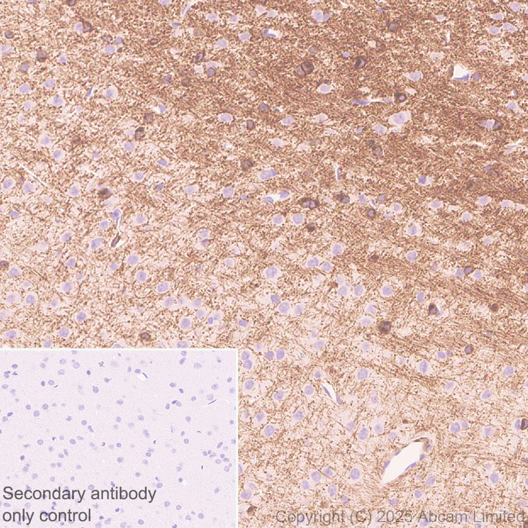 Immunohistochemistry (Formalin/PFA-fixed paraffin-embedded sections) - Anti-EDG2/LPA-1 antibody [EPR30753-555] (AB325552)