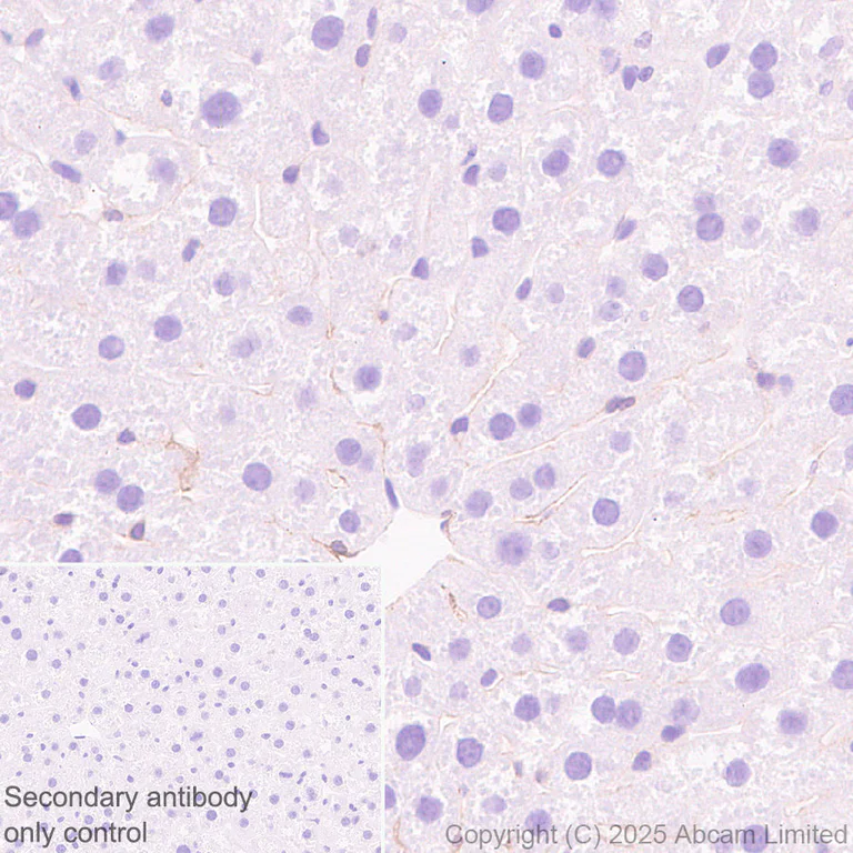 Immunohistochemistry (Formalin/PFA-fixed paraffin-embedded sections) - Anti-EDG2/LPA-1 antibody [EPR30753-555] (AB325552)
