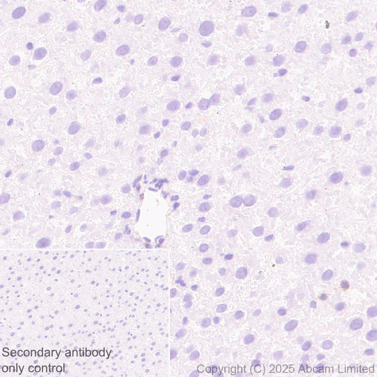 Immunohistochemistry (Formalin/PFA-fixed paraffin-embedded sections) - Anti-EDG2/LPA-1 antibody [EPR30753-555] (AB325552)