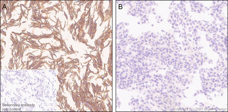 Immunohistochemistry (Formalin/PFA-fixed paraffin-embedded sections) - Anti-EDG2/LPA-1 antibody [EPR30753-555] (AB325552)