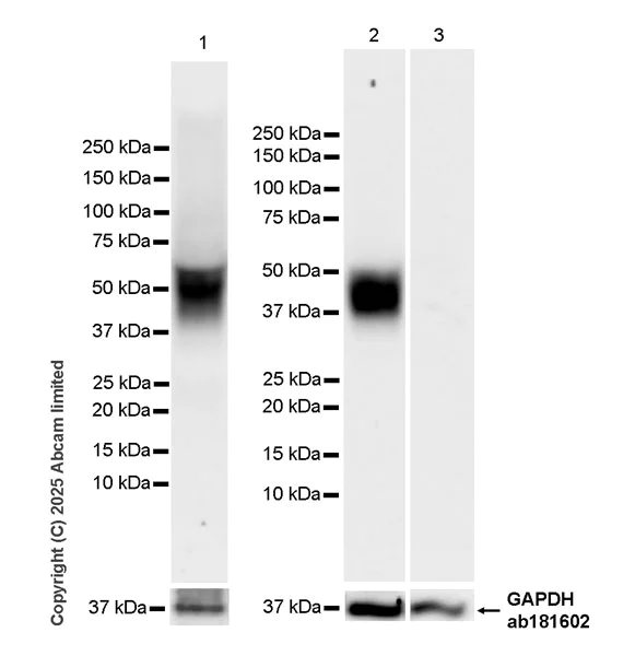 Western blot - Anti-EDG2/LPA-1 antibody [EPR30753-555] (AB325552)