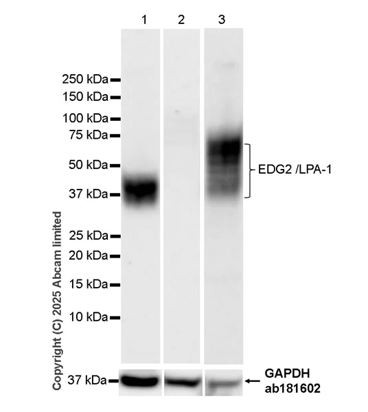 Western blot - Anti-EDG2/LPA-1 antibody [EPR30753-555] (AB325552)