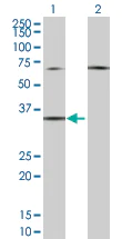 Western blot - EDG2 / LPA-1 overexpression 293T lysate (whole cell) (AB94195)