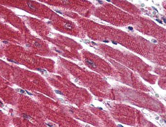 Immunohistochemistry (Formalin/PFA-fixed paraffin-embedded sections) - Anti-EDG3/S1P3 antibody (AB150573)