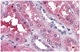 Immunohistochemistry (Formalin/PFA-fixed paraffin-embedded sections) - Anti-EDG3/S1P3 antibody (AB150573)