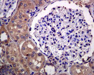 Immunohistochemistry (Formalin/PFA-fixed paraffin-embedded sections) - Anti-EDG3/S1P3 antibody [EPR4541(2)] (AB126622), expandable thumbnail