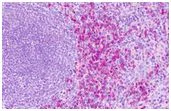 Immunohistochemistry (Formalin/PFA-fixed paraffin-embedded sections) - Anti-EDG6/S1PR4 antibody (AB188984)