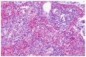 Immunohistochemistry (Formalin/PFA-fixed paraffin-embedded sections) - Anti-EDG6/S1PR4 antibody (AB188984)