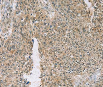 Immunohistochemistry (Formalin/PFA-fixed paraffin-embedded sections) - Anti-EDIL3/DEL1 antibody (AB198003), expandable thumbnail