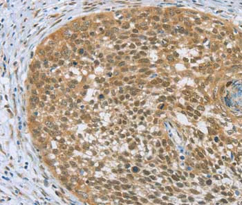 Immunohistochemistry (Formalin/PFA-fixed paraffin-embedded sections) - Anti-EDIL3/DEL1 antibody (AB198003)