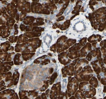 Immunohistochemistry (Formalin/PFA-fixed paraffin-embedded sections) - Anti-EDJ antibody (AB224082), expandable thumbnail