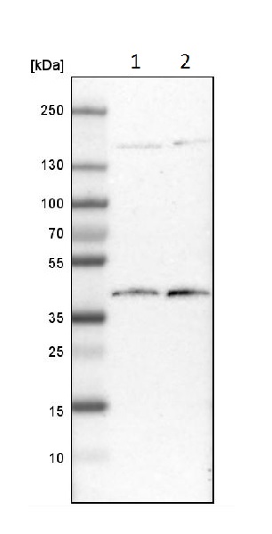 Western blot - Anti-EDJ antibody (AB224082), expandable thumbnail