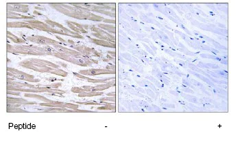 Immunohistochemistry (Formalin/PFA-fixed paraffin-embedded sections) - Anti-EDJ antibody (AB75107)