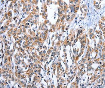 Immunohistochemistry (Formalin/PFA-fixed paraffin-embedded sections) - Anti-EDN3 antibody (AB197374)