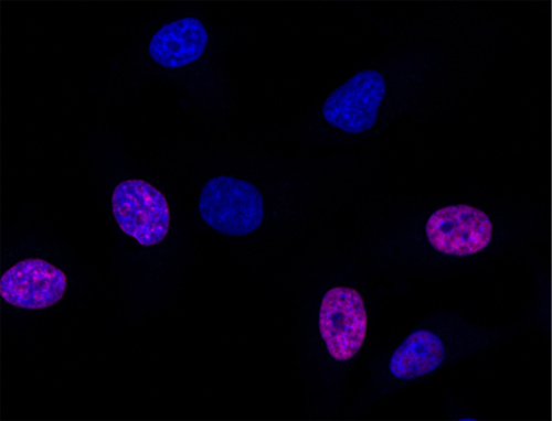 Fluorescence Microscopy - EdU Assay / EdU Staining Proliferation Kit (iFluor 647) (AB222421), expandable thumbnail
