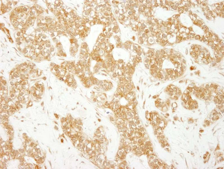 Immunohistochemistry (Formalin/PFA-fixed paraffin-embedded sections) - Anti-EEA1 antibody (AB264245)
