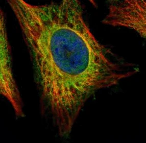 Immunocytochemistry/ Immunofluorescence - Anti-EEA1 antibody - C-terminal (AB137403)