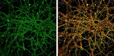 Immunocytochemistry/ Immunofluorescence - Anti-EEA1 antibody - C-terminal (AB137403)