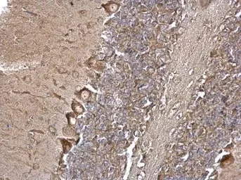 Immunohistochemistry (Formalin/PFA-fixed paraffin-embedded sections) - Anti-EEA1 antibody - C-terminal (AB137403)