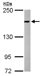 Western blot - Anti-EEA1 antibody - C-terminal (AB137403)