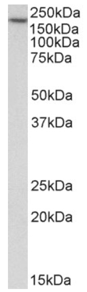 Western blot - Anti-EEA1 antibody - Early Endosome Marker (AB206860), expandable thumbnail