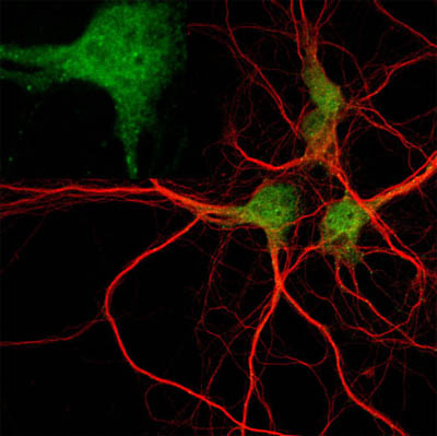 Immunocytochemistry/ Immunofluorescence - Anti-EEA1 antibody - Early Endosome Marker (AB2900), expandable thumbnail