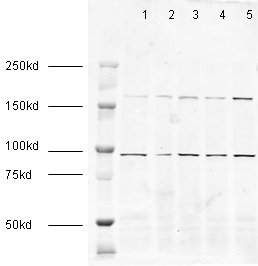 Western blot - Anti-EEA1 antibody - Early Endosome Marker (AB2900), expandable thumbnail