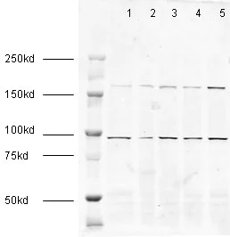 Western blot - Anti-EEA1 antibody - Early Endosome Marker (AB2900)