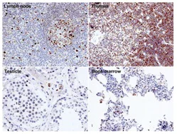 Immunohistochemistry (Formalin/PFA-fixed paraffin-embedded sections) - Anti-EED antibody [163C] (AB126542)