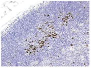 Immunohistochemistry (Formalin/PFA-fixed paraffin-embedded sections) - Anti-EED antibody [163C] (AB126542)