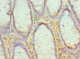 Immunohistochemistry (Formalin/PFA-fixed paraffin-embedded sections) - Anti-EED antibody (AB236292), expandable thumbnail