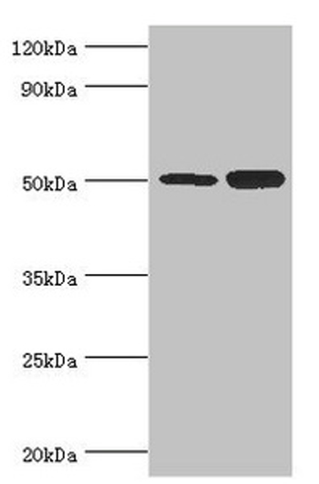 Western blot - Anti-EED antibody (AB236292), expandable thumbnail