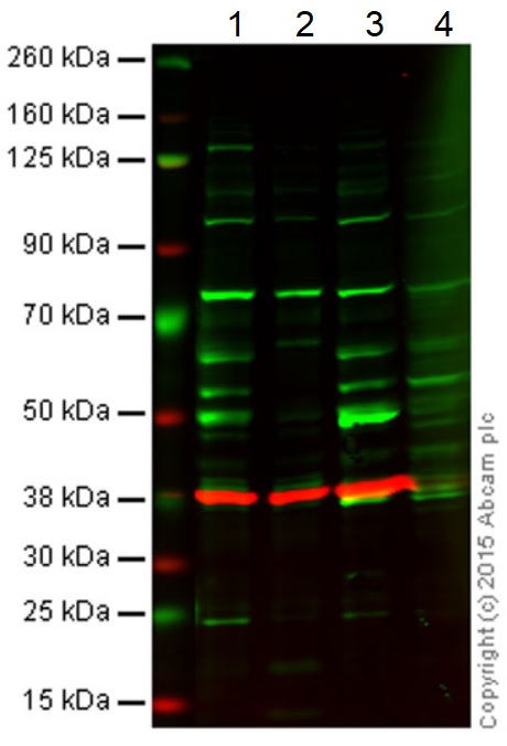 Anti-EED antibody
