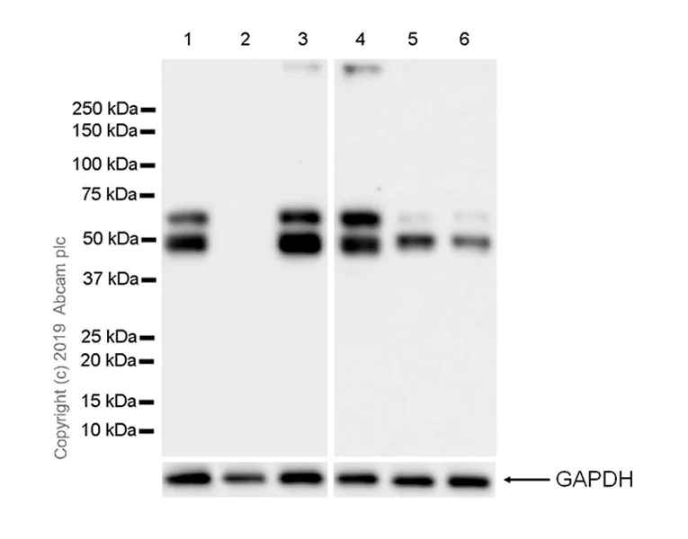 Western blot - Anti-EED antibody [EPR23043-5] - BSA and Azide free (AB264566)