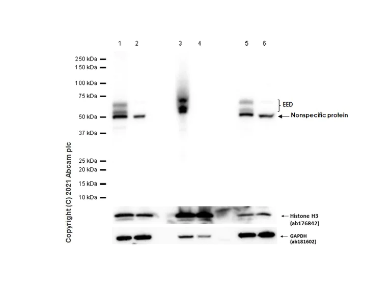Western blot - Anti-EED antibody [EPR23043-5] - ChIP Grade (AB240650)
