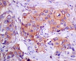 Immunohistochemistry (Formalin/PFA-fixed paraffin-embedded sections) - Anti-eEF1A1/EF-Tu + eEF1A1 + EE1AL3/EEF1A1P5 antibody [EPR9470] (AB140632)