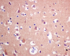 Immunohistochemistry (Formalin/PFA-fixed paraffin-embedded sections) - Anti-eEF1A1/EF-Tu + eEF1A1 + EE1AL3/EEF1A1P5 antibody [EPR9470] (AB140632)