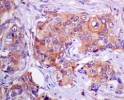 Immunohistochemistry (Formalin/PFA-fixed paraffin-embedded sections) - Anti-eEF1A1/EF-Tu + eEF1A1 + EE1AL3/EEF1A1P5 antibody [EPR9470] - BSA and Azide free (AB186380)