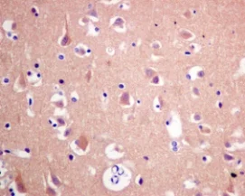 Immunohistochemistry (Formalin/PFA-fixed paraffin-embedded sections) - Anti-eEF1A1/EF-Tu + eEF1A1 + EE1AL3/EEF1A1P5 antibody [EPR9470] - BSA and Azide free (AB186380)