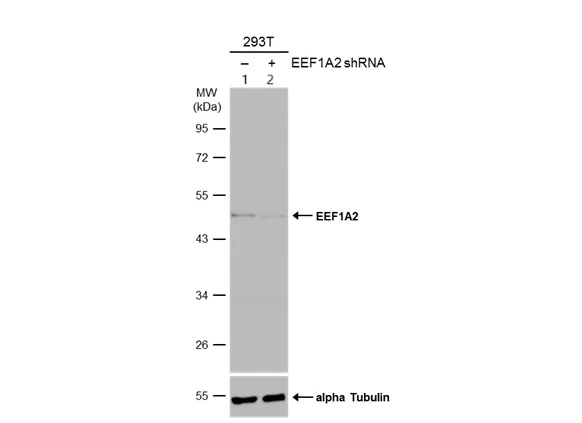 Western blot - Anti-EEF1A2 antibody (AB153714)