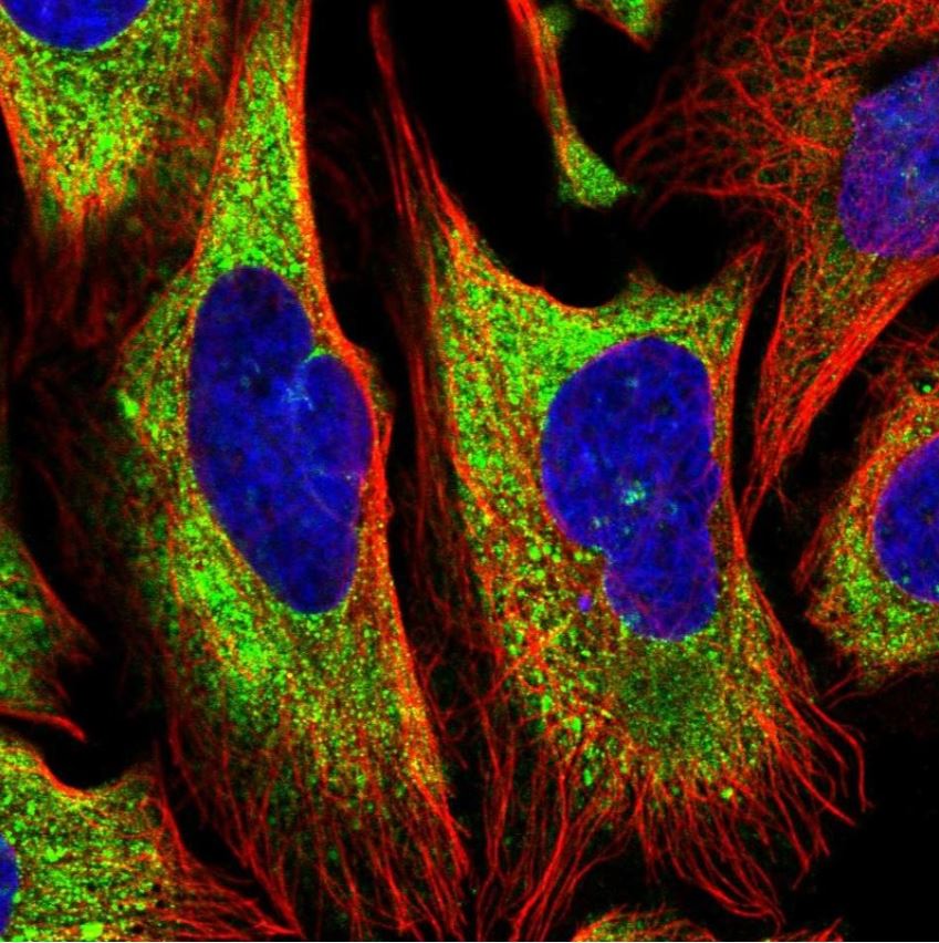 Immunocytochemistry/ Immunofluorescence - Anti-EEF1A2 antibody (AB212172), expandable thumbnail