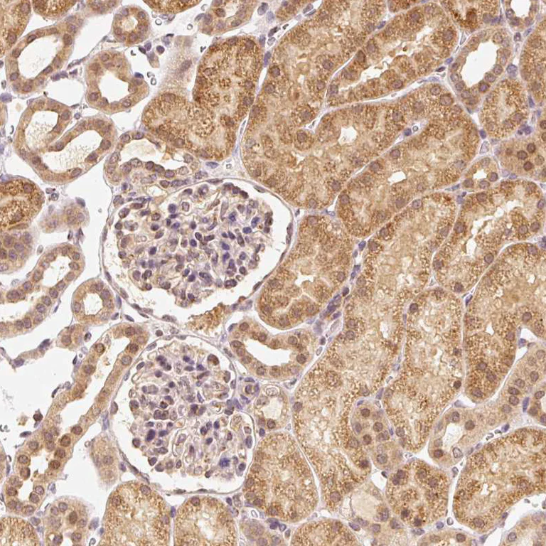 Immunohistochemistry (Formalin/PFA-fixed paraffin-embedded sections) - Anti-EEF1A2 antibody (AB212172)