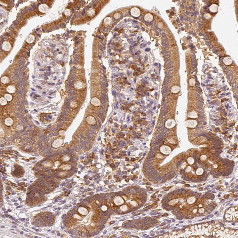 Immunohistochemistry (Formalin/PFA-fixed paraffin-embedded sections) - Anti-EEF1A2 antibody (AB212172), expandable thumbnail