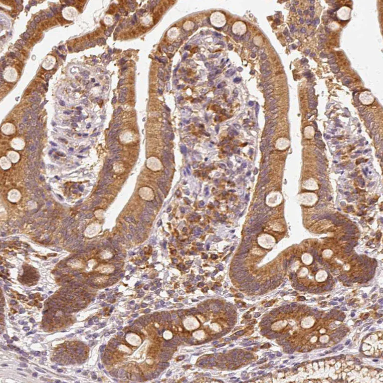 Immunohistochemistry (Formalin/PFA-fixed paraffin-embedded sections) - Anti-EEF1A2 antibody (AB212172)